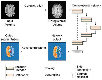 Multi-Modal Segmentation of 3D Brain Scans Using Neural Networks